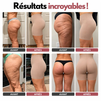 Short Modellante Curvely™ | Comfort assoluto, sostegno perfetto, anti-arrotolamento